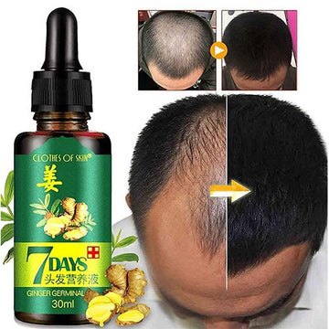 7 Day Ginger Germinal Oil Hair Nutrient Solution